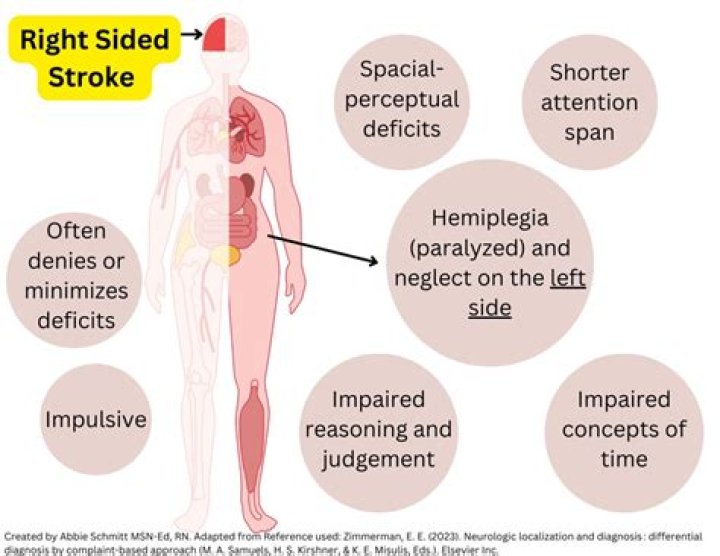 Are you ever the same after a stroke?