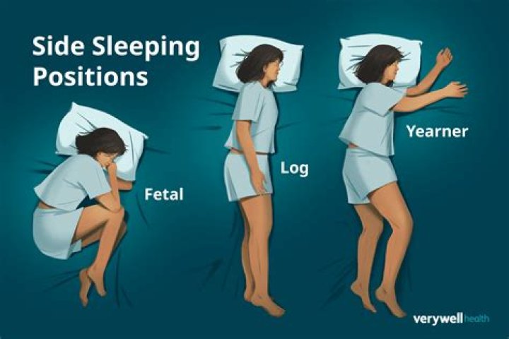 Can I sleep on my side with a catheter?