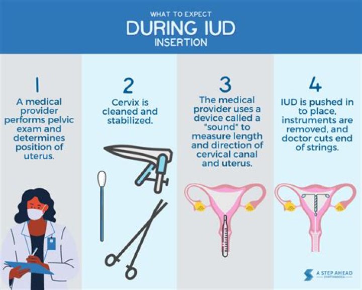 How long does the pain last after IUD insertion?