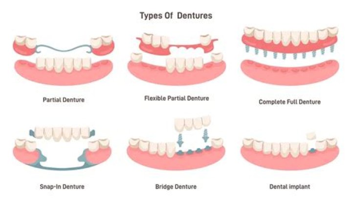 How uncomfortable are dentures?
