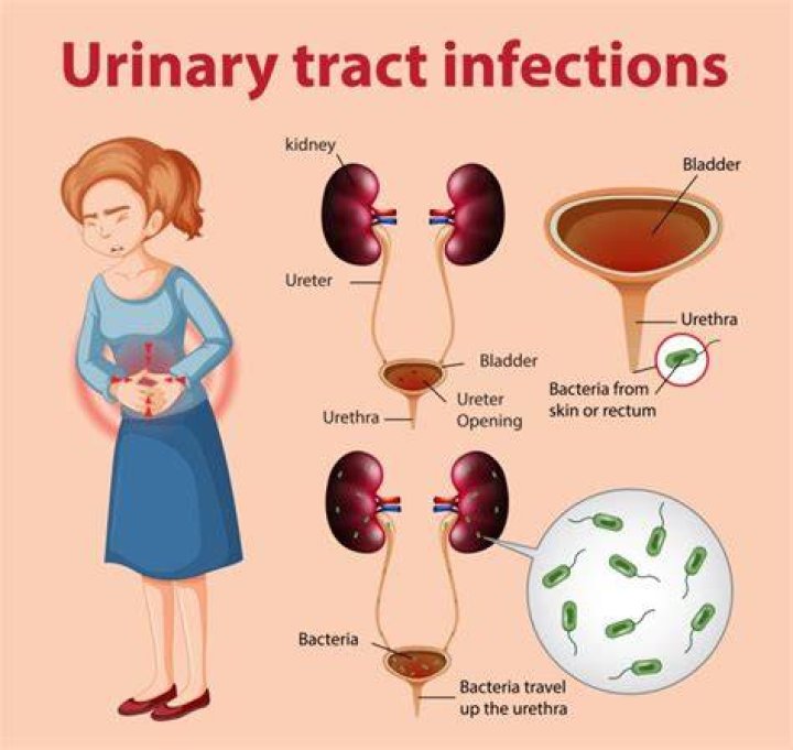 What causes urine infection?