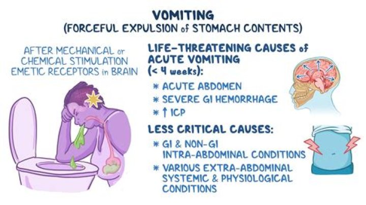 What happens if you vomit during endoscopy?