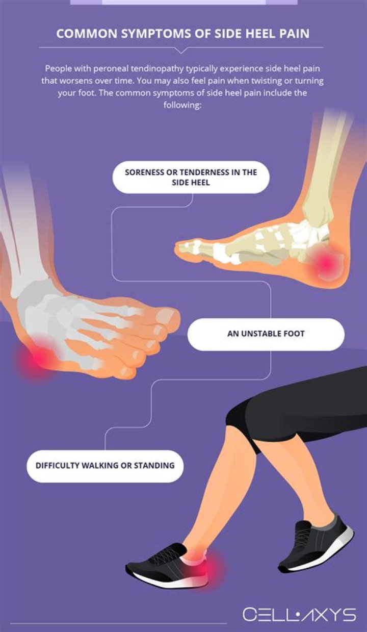 Why does it hurt to walk on my feet when I wake up?